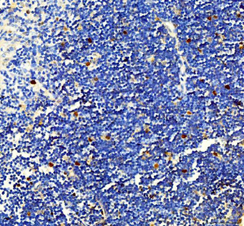 Survivin/BIRC5 Rabbit Polyclonal Antibody