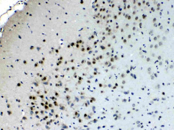 Choline Acetyltransferase/CHAT Rabbit Polyclonal Antibody