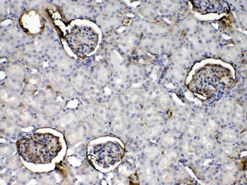 C Reactive Protein/Crp Rabbit Polyclonal Antibody