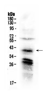CXCR4 Rabbit Polyclonal Antibody