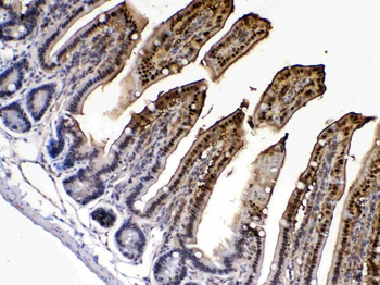 FABP2/I-FABP/FABP Rabbit Polyclonal Antibody