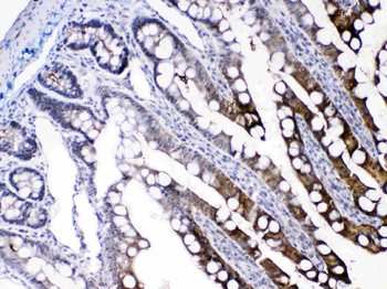 FABP2/I-FABP/FABP Rabbit Polyclonal Antibody