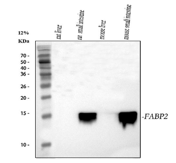 FABP2/I-FABP/FABP Rabbit Polyclonal Antibody