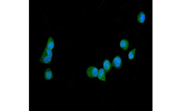GAS 6/GAS6 Rabbit Polyclonal Antibody