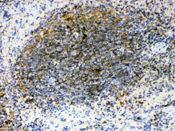 GAS 6/GAS6 Rabbit Polyclonal Antibody