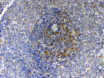 GAS 6/GAS6 Rabbit Polyclonal Antibody