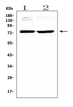 GAS 6/GAS6 Rabbit Polyclonal Antibody