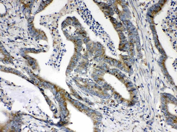 Hydroxysteroid Dehydrogenase 4/HSD17B4 Rabbit Polyclonal Antibody