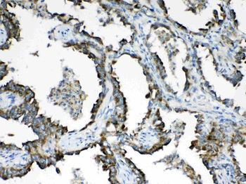 Hydroxysteroid Dehydrogenase 4/HSD17B4 Rabbit Polyclonal Antibody