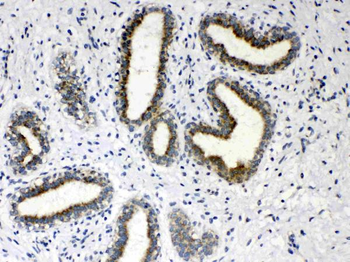 Hydroxysteroid Dehydrogenase 4/HSD17B4 Rabbit Polyclonal Antibody