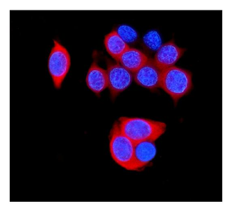 HSPB8/Hsp22 Rabbit Polyclonal Antibody
