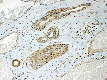 HSPB8/Hsp22 Rabbit Polyclonal Antibody