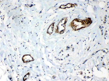 HSPB8/Hsp22 Rabbit Polyclonal Antibody