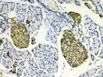 HSPB8/Hsp22 Rabbit Polyclonal Antibody