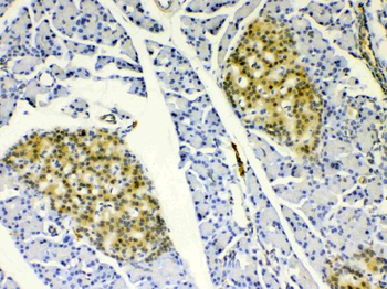 HSPB8/Hsp22 Rabbit Polyclonal Antibody