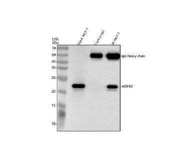 HSPB8/Hsp22 Rabbit Polyclonal Antibody