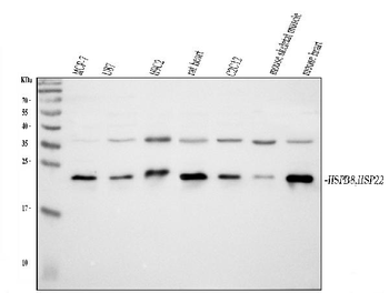 HSPB8/Hsp22 Rabbit Polyclonal Antibody