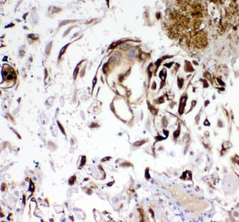 IGFBP1 Rabbit Polyclonal Antibody