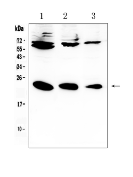 IL-2/IL2/IL Rabbit Polyclonal Antibody
