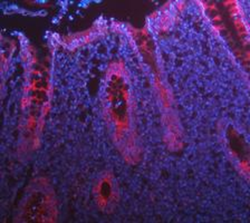 Cytokeratin 8/KRT8 Rabbit Polyclonal Antibody