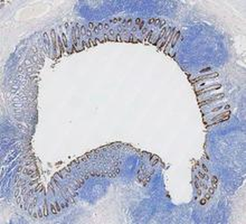 Cytokeratin 8/KRT8 Rabbit Polyclonal Antibody