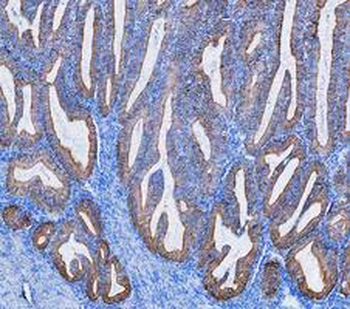 Cytokeratin 8/KRT8 Rabbit Polyclonal Antibody