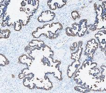 Cytokeratin 8/KRT8 Rabbit Polyclonal Antibody