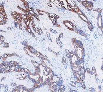 Cytokeratin 8/KRT8 Rabbit Polyclonal Antibody