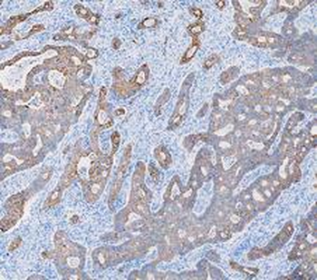 Cytokeratin 8/KRT8 Rabbit Polyclonal Antibody
