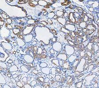 Cytokeratin 8/KRT8 Rabbit Polyclonal Antibody