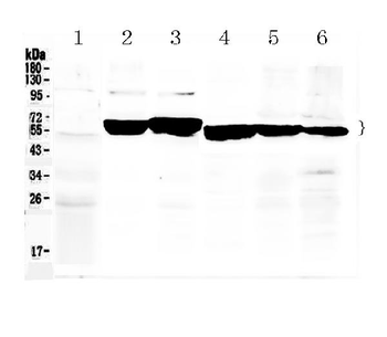 Cytokeratin 8/KRT8 Rabbit Polyclonal Antibody