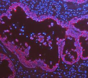 Cytokeratin 8/KRT8 Rabbit Polyclonal Antibody