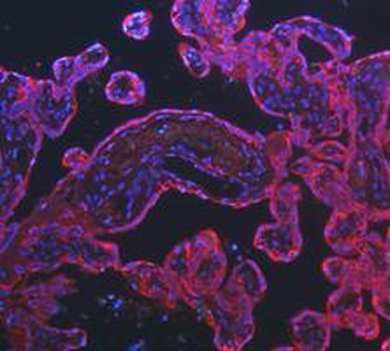 Cytokeratin 8/KRT8 Rabbit Polyclonal Antibody