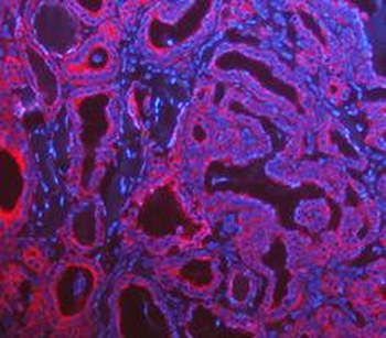Cytokeratin 8/KRT8 Rabbit Polyclonal Antibody