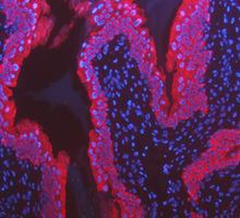 Cytokeratin 8/KRT8 Rabbit Polyclonal Antibody