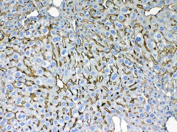 Cytokeratin 8/KRT8 Rabbit Polyclonal Antibody