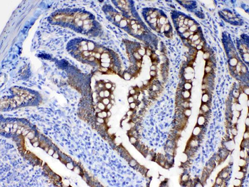 Cytokeratin 8/KRT8 Rabbit Polyclonal Antibody