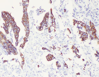Cytokeratin 8/KRT8 Rabbit Polyclonal Antibody
