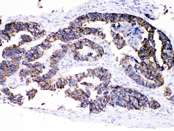 Cytokeratin 8/KRT8 Rabbit Polyclonal Antibody