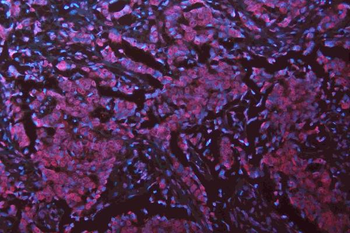 Musashi 1/Msi1 Rabbit Polyclonal Antibody