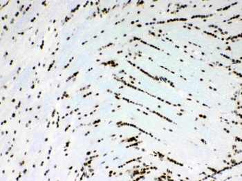 Musashi 1/Msi1 Rabbit Polyclonal Antibody