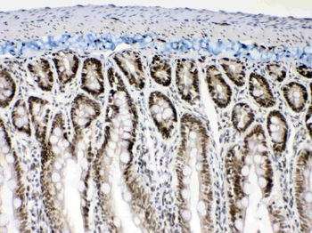 Musashi 1/Msi1 Rabbit Polyclonal Antibody