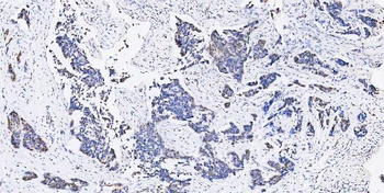 Musashi 1/Msi1 Rabbit Polyclonal Antibody