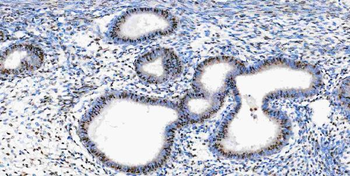 Musashi 1/Msi1 Rabbit Polyclonal Antibody