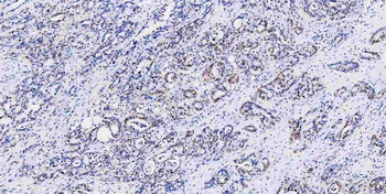 Musashi 1/Msi1 Rabbit Polyclonal Antibody