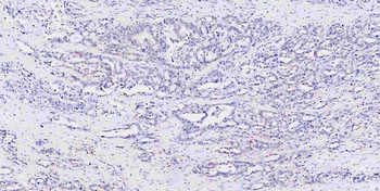 Musashi 1/Msi1 Rabbit Polyclonal Antibody