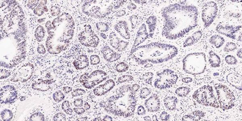 Musashi 1/Msi1 Rabbit Polyclonal Antibody