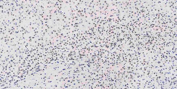 Musashi 1/Msi1 Rabbit Polyclonal Antibody