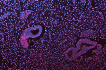 Musashi 1/Msi1 Rabbit Polyclonal Antibody