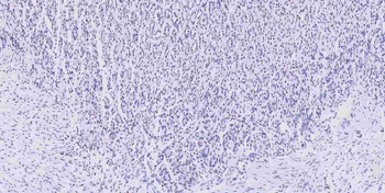 Musashi 1/Msi1 Rabbit Polyclonal Antibody